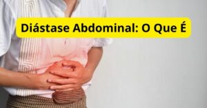 Diástase Abdominal: O Que É